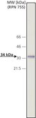 Monoclonal Anti-Cathepsin D antibody produced in mouse clone CTD-19, ascites fluid