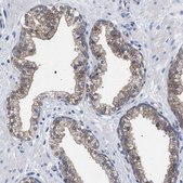 Anti-GMPR antibody produced in rabbit Prestige Antibodies® Powered by Atlas Antibodies, affinity isolated antibody, buffered aqueous glycerol solution