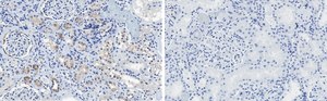 Anti-CDK6 Antibody, clone 2J3 ZooMAb® Rabbit Monoclonal recombinant, expressed in HEK 293 cells