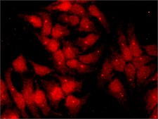 Anti-Chk1 antibody, Mouse monoclonal ~2 mg/mL, clone DCS-310, purified from hybridoma cell culture