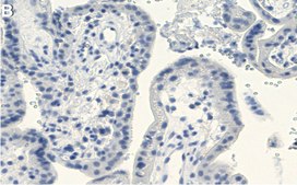 Anti-Laminin β1 Antibody, clone 4E10 ZooMAb® Mouse Monoclonal recombinant, expressed in HEK 293 cells