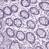 抗-SPAG6 兔抗 Prestige Antibodies® Powered by Atlas Antibodies, affinity isolated antibody, buffered aqueous glycerol solution