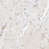 Anti-BCAP31 antibody produced in rabbit Prestige Antibodies® Powered by Atlas Antibodies, affinity isolated antibody, buffered aqueous glycerol solution