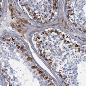 Anti-PGM2 antibody produced in rabbit Prestige Antibodies® Powered by Atlas Antibodies, affinity isolated antibody, buffered aqueous glycerol solution