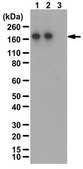 Anti-phospho TIE2/TEK Antibody (Tyr992) 0.25 mg/mL, from rabbit
