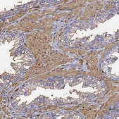 Anti-ACTB antibody produced in rabbit Prestige Antibodies® Powered by Atlas Antibodies, affinity isolated antibody, buffered aqueous glycerol solution