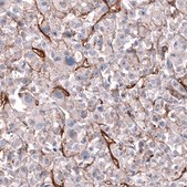 Anti-MCAM antibody produced in mouse Prestige Antibodies® Powered by Atlas Antibodies, clone CL12855, purified by using Protein A, buffered aqueous glycerol solution