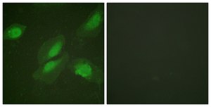 Anti-AKT antibody produced in rabbit affinity isolated antibody