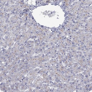 Anti-ABCB4 antibody produced in rabbit Prestige Antibodies® Powered by Atlas Antibodies, affinity isolated antibody, buffered aqueous glycerol solution