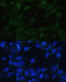 Anti-TRPV1 antibody produced in rabbit