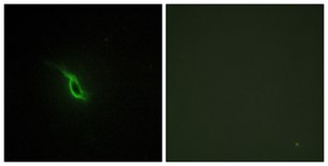 抗-肾上腺素受体 α-2A 兔抗 affinity isolated antibody