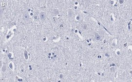 Anti-Ago2 Antibody, clone 2H10 ZooMAb® Rabbit Monoclonal recombinant, expressed in HEK 293 cells