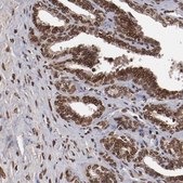 Anti-AKT1 antibody produced in rabbit Prestige Antibodies® Powered by Atlas Antibodies, affinity isolated antibody, buffered aqueous glycerol solution