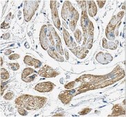 Anti-VDAC1 Antibody, clone N152B/23 clone N152B/23, from mouse