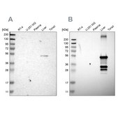 Anti-CYP2C8 antibody produced in rabbit Prestige Antibodies® Powered by Atlas Antibodies, affinity isolated antibody, buffered aqueous glycerol solution