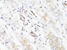 Anti-Vimentin antibody produced in rabbit