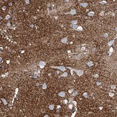 Anti-SLC1A3 antibody produced in rabbit Prestige Antibodies® Powered by Atlas Antibodies, affinity isolated antibody, buffered aqueous glycerol solution