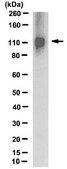 Anti-NMDAR1 Antibody, clone 1.17.2.6, rabbit monoclonal clone 1.17.2.6, from rabbit, unconjugated