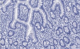 Anti-ATM Antibody, clone 4N19, ZooMAb® Rabbit Monoclonal recombinant, expressed in HEK 293 cells