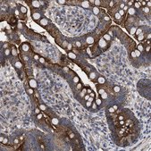 Anti-TTC19 antibody produced in rabbit Prestige Antibodies® Powered by Atlas Antibodies, affinity isolated antibody, buffered aqueous glycerol solution