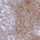 Anti-PGM5 Prestige Antibodies® Powered by Atlas Antibodies, affinity isolated antibody