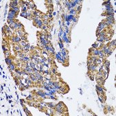 Anti-p53 antibody produced in rabbit