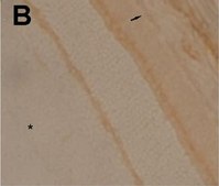 Anti-Na+K+ ATPase α-2 Antibody serum, Upstate®