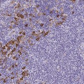 Anti-TLR7 antibody produced in rabbit Prestige Antibodies® Powered by Atlas Antibodies, affinity isolated antibody, buffered aqueous glycerol solution