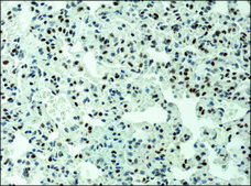 Anti-acetyl-Histone H3 (Ac-Lys9) antibody produced in rabbit 2-2.5 mg/mL, affinity isolated antibody, buffered aqueous solution