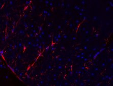 抗GFAP抗体，Cy3偶联物 from mouse, CY3 conjugate