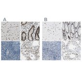 Anti-NFIA antibody produced in rabbit Prestige Antibodies® Powered by Atlas Antibodies, affinity isolated antibody, buffered aqueous glycerol solution