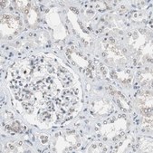 Anti-TOP2A antibody produced in rabbit Prestige Antibodies® Powered by Atlas Antibodies, affinity isolated antibody, buffered aqueous glycerol solution, Ab1