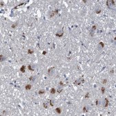 Anti-LTA antibody produced in rabbit Prestige Antibodies® Powered by Atlas Antibodies, affinity isolated antibody, buffered aqueous glycerol solution