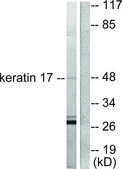 Anti-Keratin 17 antibody produced in rabbit affinity isolated antibody