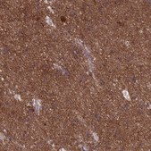 Anti-DNM1L antibody produced in rabbit Prestige Antibodies® Powered by Atlas Antibodies, affinity isolated antibody, buffered aqueous glycerol solution