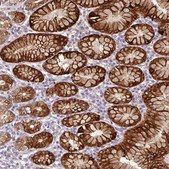 Anti-CTSE antibody produced in rabbit Prestige Antibodies® Powered by Atlas Antibodies, affinity isolated antibody, buffered aqueous glycerol solution