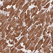 Anti-HRC antibody produced in rabbit Prestige Antibodies® Powered by Atlas Antibodies, affinity isolated antibody, buffered aqueous glycerol solution