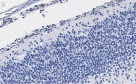 Anti-Reelin Antibody, clone G10 ZooMAb® Mouse Monoclonal recombinant, expressed in HEK 293 cells