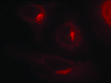Anti-phospho-GSK3A (pSer21) antibody produced in rabbit affinity isolated antibody