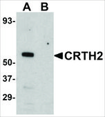Anti-CRTH2 antibody produced in rabbit affinity isolated antibody, buffered aqueous solution