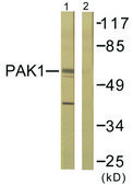Anti-PAK1 antibody produced in rabbit affinity isolated antibody