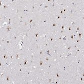Anti-HNRNPA0 antibody produced in rabbit Prestige Antibodies® Powered by Atlas Antibodies, affinity isolated antibody