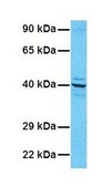 Anti-G6PC affinity isolated antibody