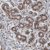 Monoclonal Anti-DAXX antibody produced in mouse Prestige Antibodies® Powered by Atlas Antibodies, clone CL3580, purified immunoglobulin, buffered aqueous glycerol solution