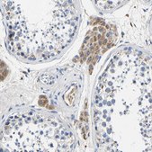 Anti-SLC25A25 antibody produced in rabbit Prestige Antibodies® Powered by Atlas Antibodies, affinity isolated antibody, buffered aqueous glycerol solution