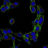 Anti-Dynein Antibody, IC, cytosolic, clone 74.1, Alexa Fluor™ 647 conjugate clone 74.1, from mouse, ALEXA FLUOR™ 647