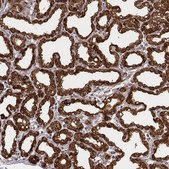 Anti-CSN3 antibody produced in rabbit Prestige Antibodies® Powered by Atlas Antibodies, affinity isolated antibody