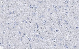 Anti-Trk-B Antibody, clone 2B22 ZooMAb® Rabbit Monoclonal recombinant, expressed in HEK 293 cells