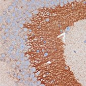 Anti-PRKAR2B antibody produced in rabbit