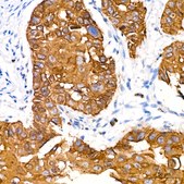 Anti-Cytokeratin 14 (KRT14) Antibody, clone 5Z4O9, Rabbit Monoclonal
